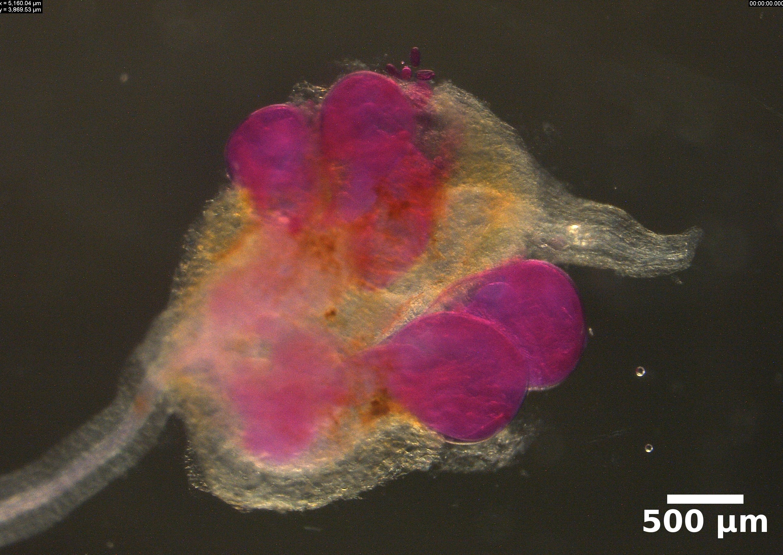 M. hapla females in bean roots stained with acid fuchsin dye.